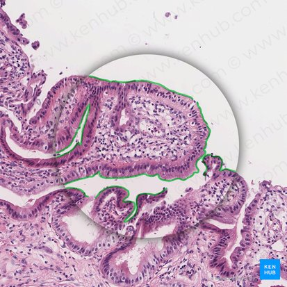 <p><strong>Tiny, hairlike projections</strong> of the plasma membrane of the absorptive epithelial cells; form the brush border; greatly increase surface area; contain brush border enzymes that complete the digestion of carbohydrates and proteins.</p>