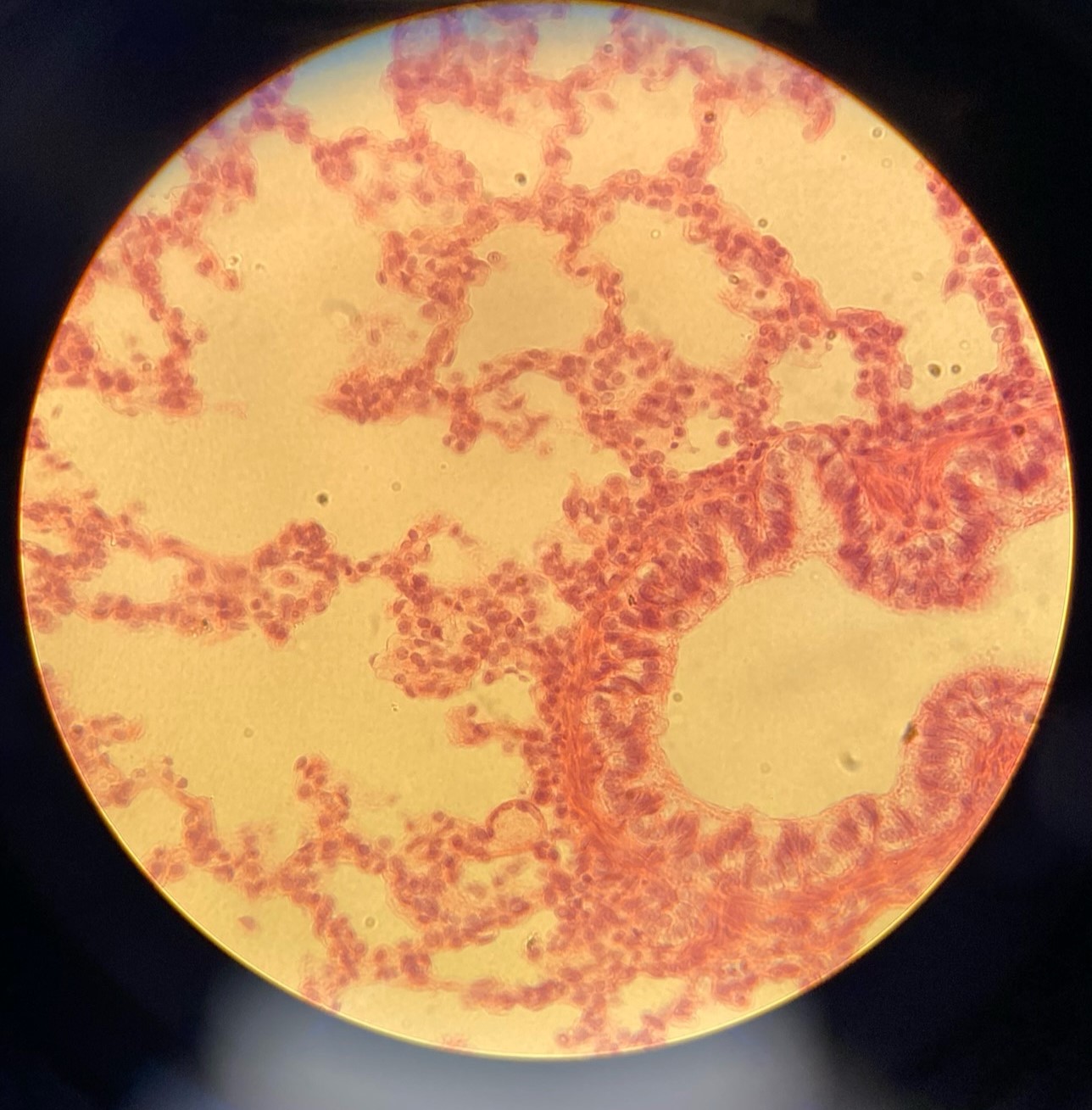<p>example: alveoli of lung<br>function: diffusion and filtration<br><br>a single layer thick; flattened and scale like</p>