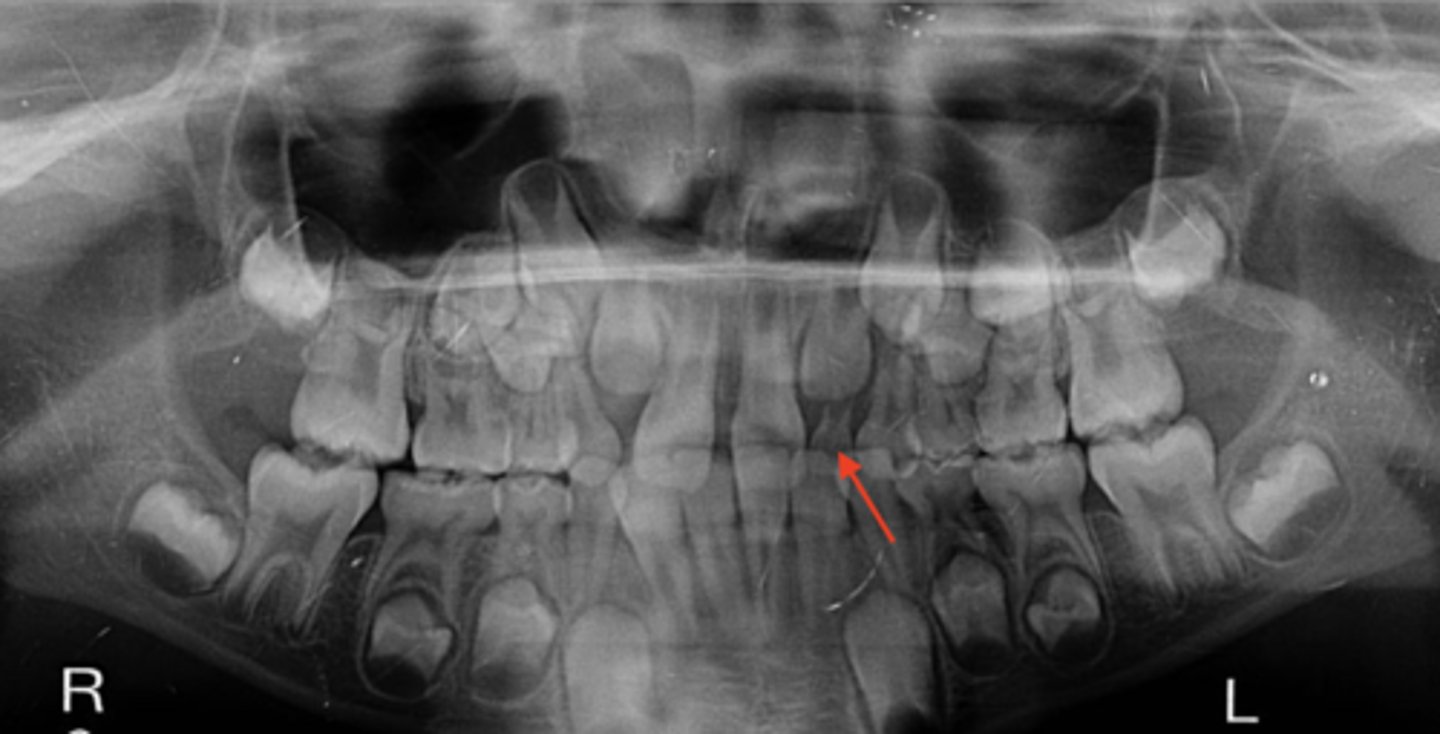 knowt flashcard image