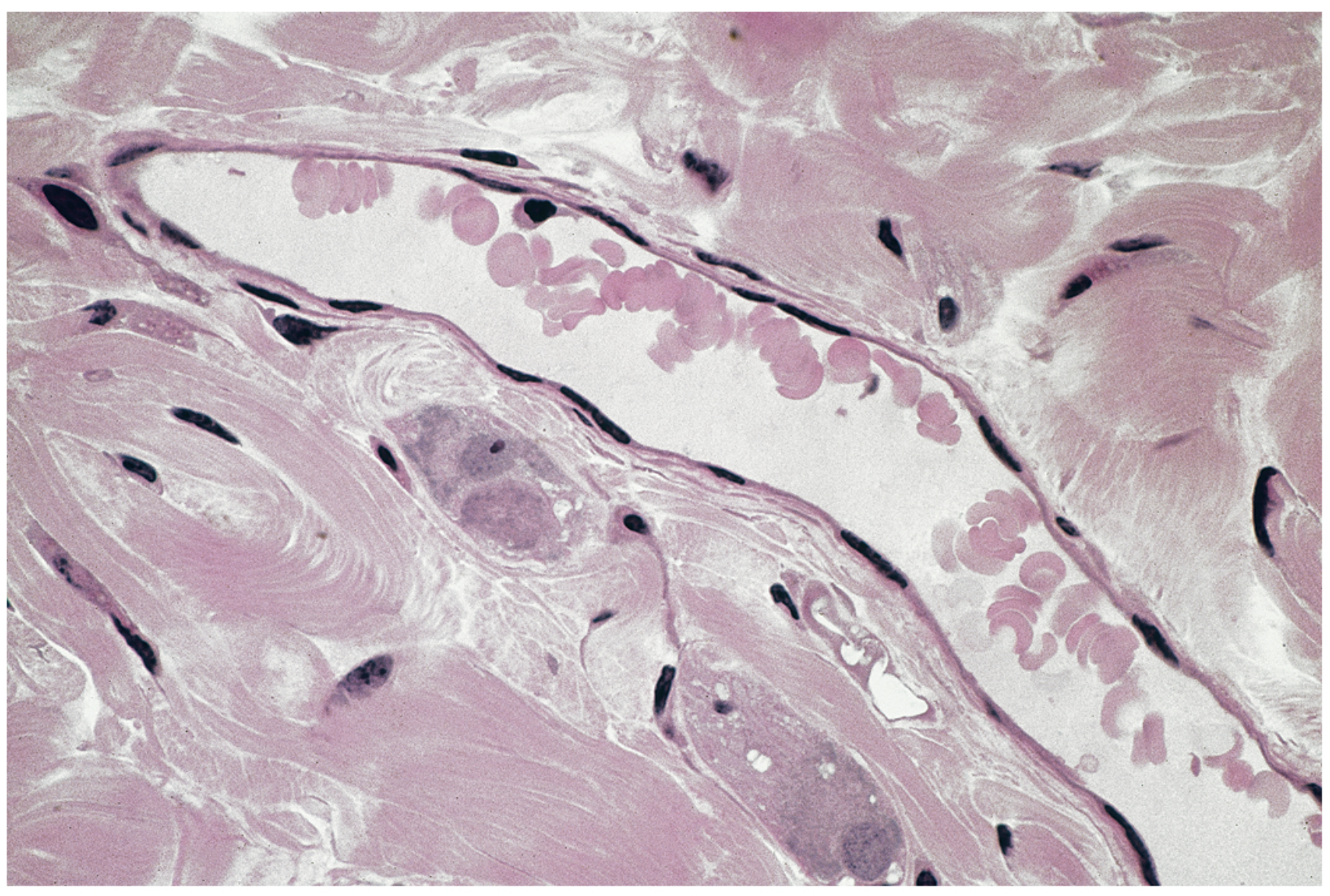 <p>Simple squamous epithelium.</p>