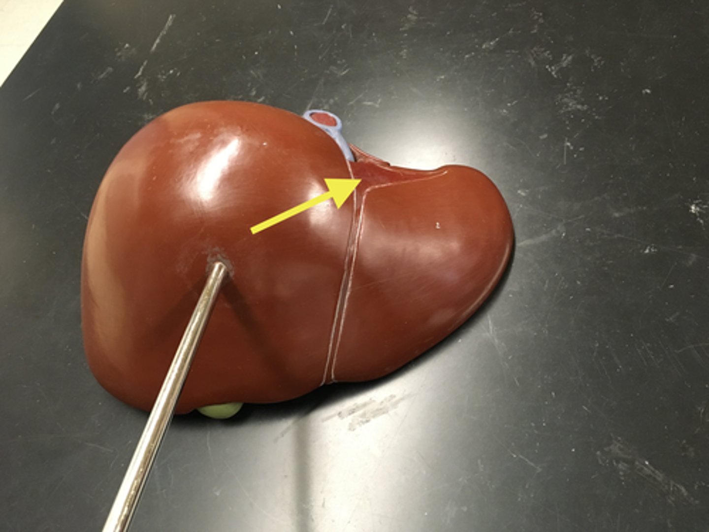 <p>goes from top, around and to the bottom</p><p>- anchors the liver to the diaphragm</p>