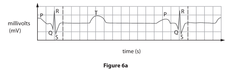<p>Figure 6a shows an electrocardiogram (ECG) trace during the cardiac cycle.&nbsp;</p><p>Identify the letter on Figure 6a that represents when the atria contract. (1)</p><p>A- P</p><p>B- R</p><p>C- S</p><p>D- T</p>