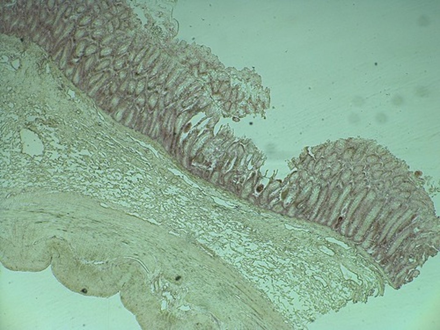 <p>This is a slide of what region of the GI tract?</p>