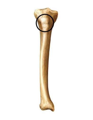 <p>what part of the tibia is this?</p>