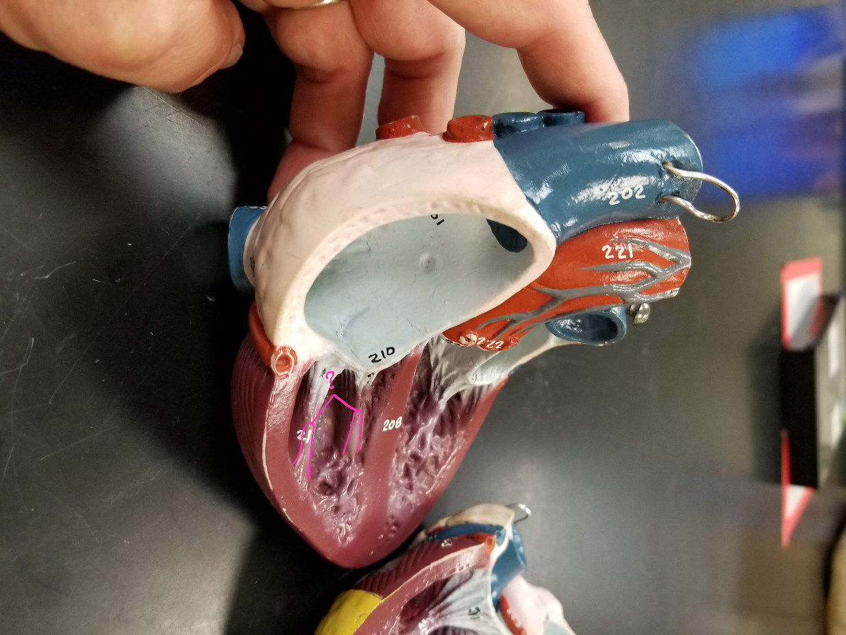 <p>what is outlined in pink?</p>