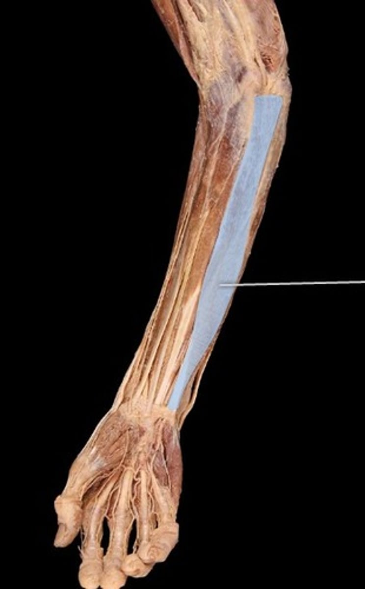 <p>What muscle is this?</p>