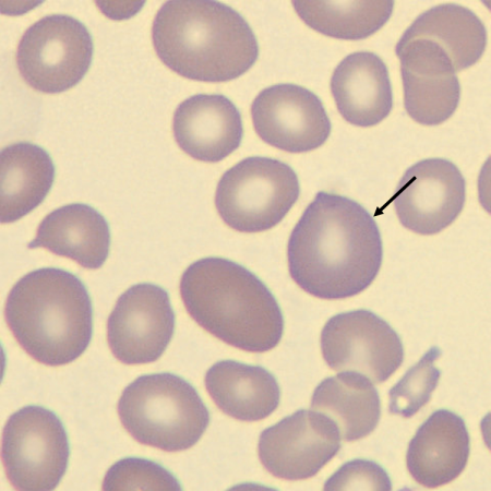 <p>What characteristic describes the size of this erythrocyte?</p>