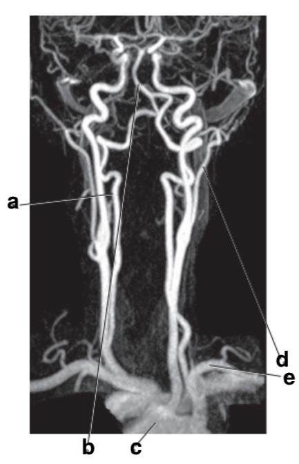 <p>What is letter d?</p>