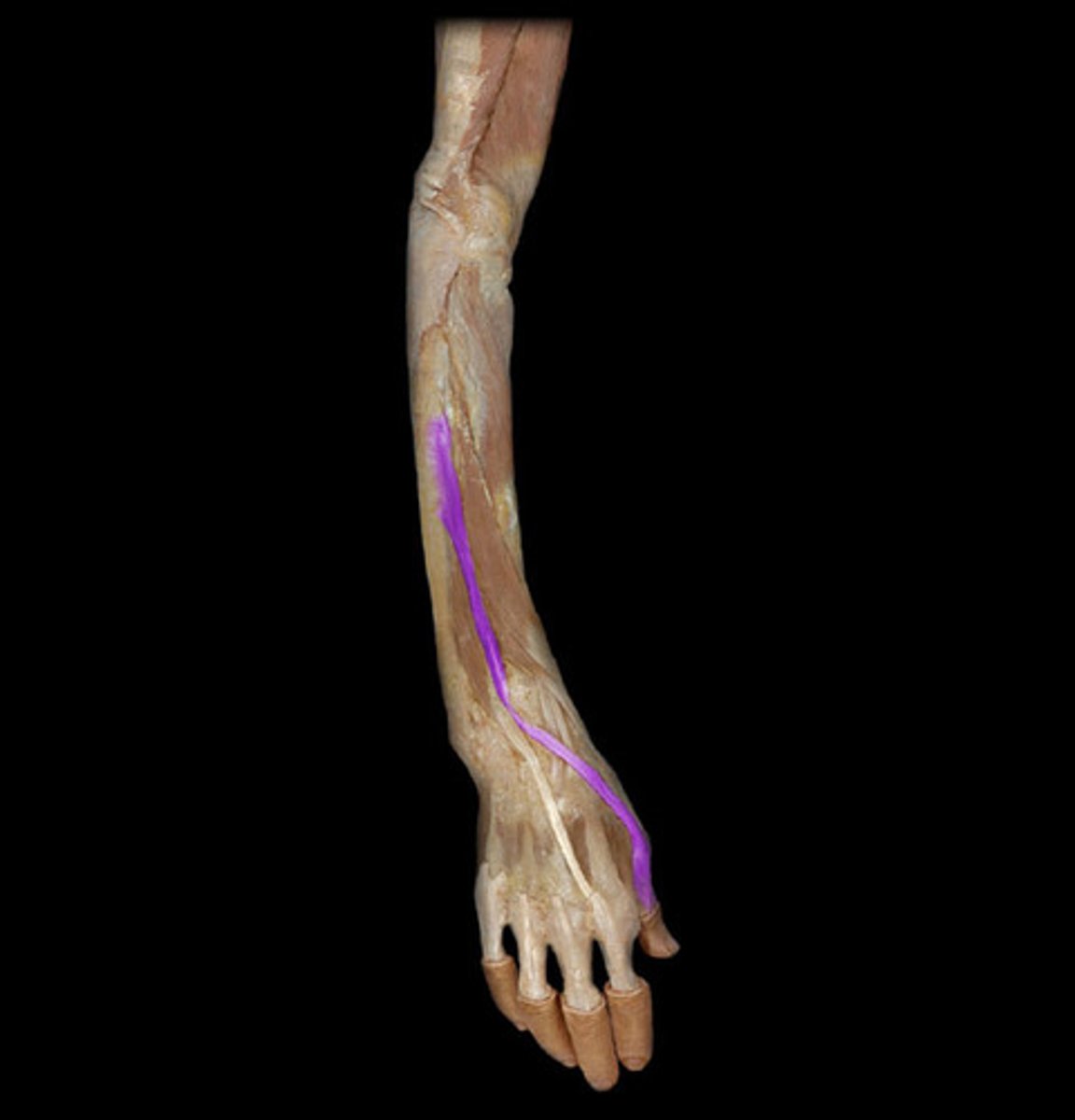 <p>- Origin = posterior ulna and interosseous membrane</p><p>- Insertion = distal phalanx of digit 1 (thumb)</p><p>- Primary Actions = extends MCP and IP of thumb, adducts, and laterally rotates thumb</p><p>- Innervation = radial nerve</p>