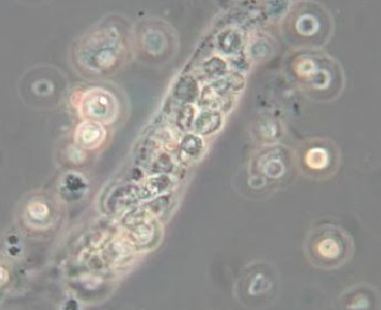 <p>What do you see in this image? Abnormal or normal?</p>