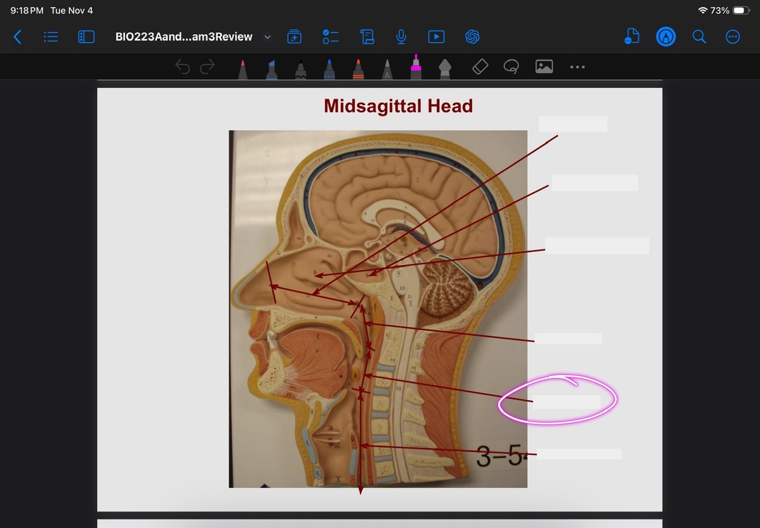 <p>What is this?</p>