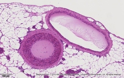 <p>what type of blood vessels?</p>