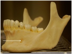 Name this foramen.