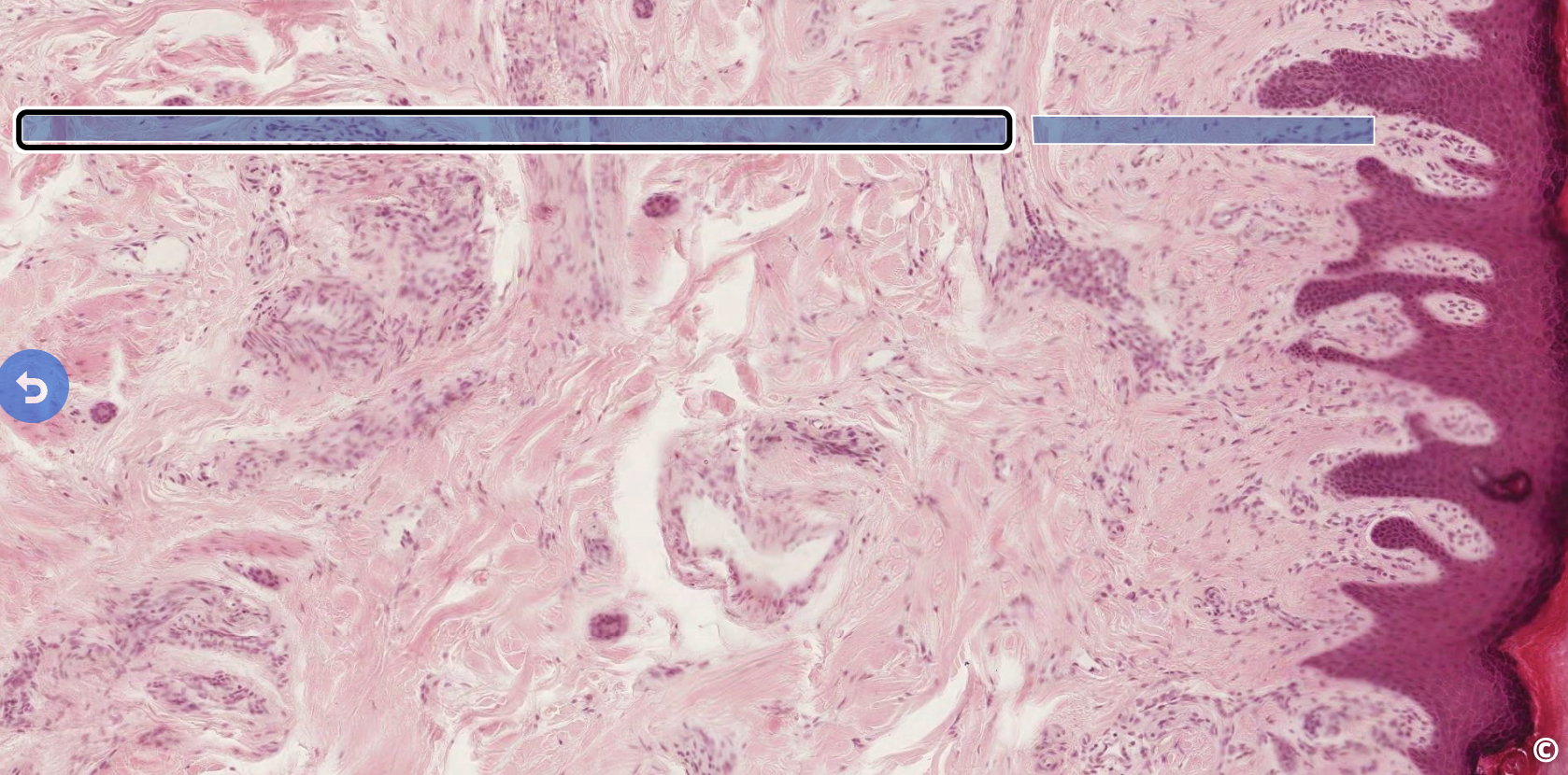 <p>identify the layers of the dermis</p>
