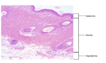 <p>top - epidermis</p><p>mid - dermis</p><p>bot - hypodermis</p>