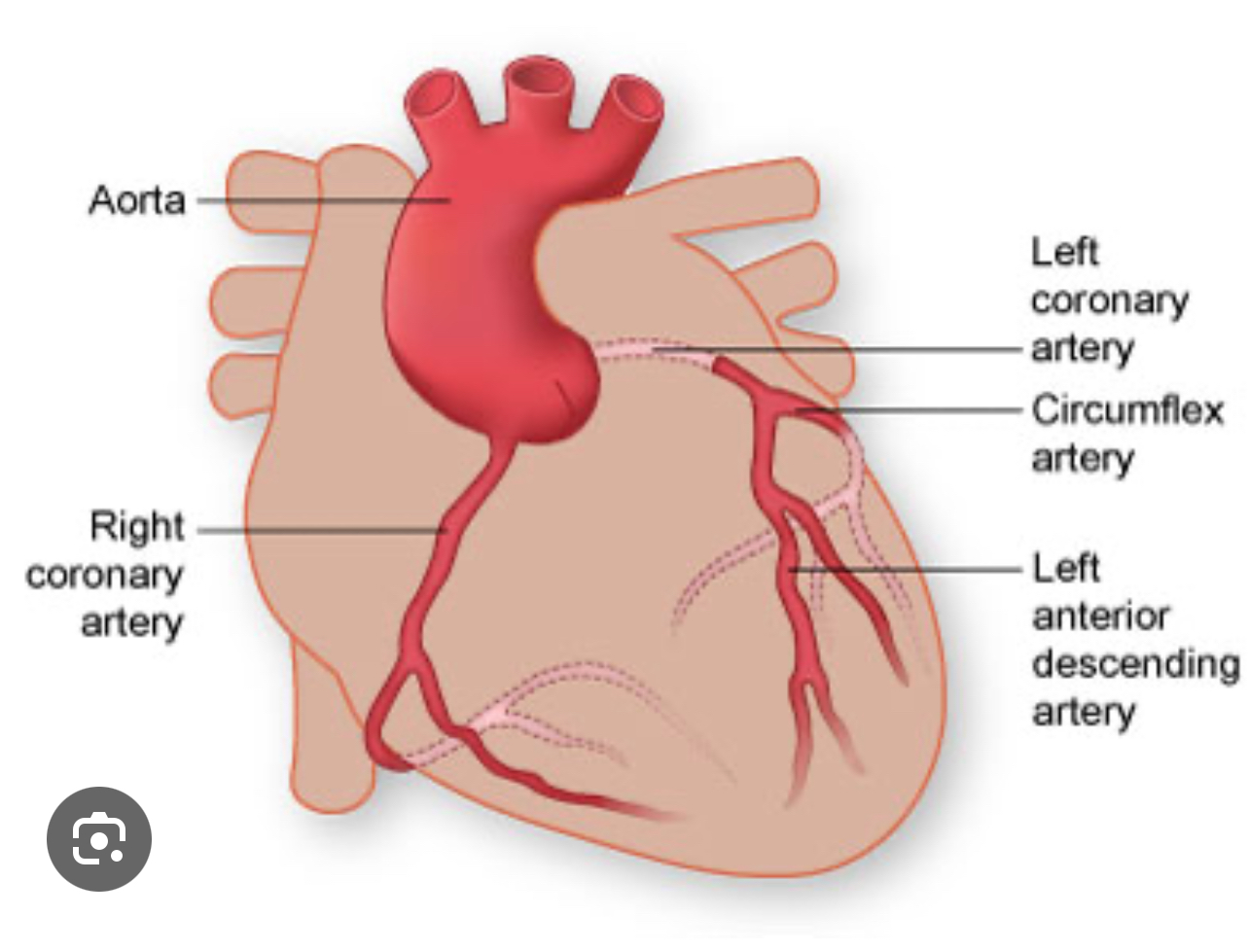 <p>Type of MI/ site of MI</p>