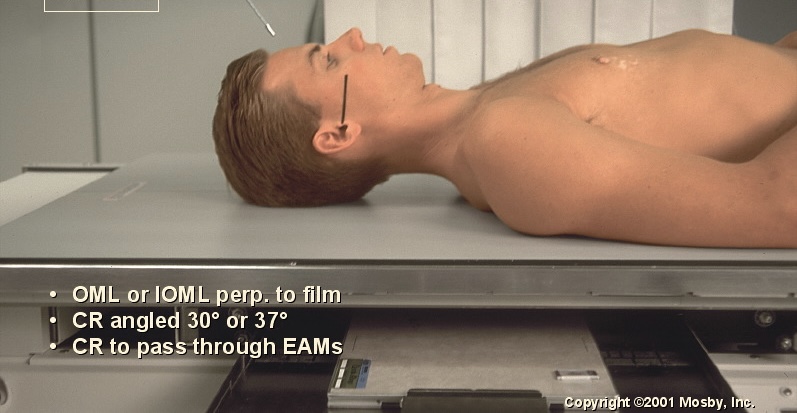<p>What position is this?</p>