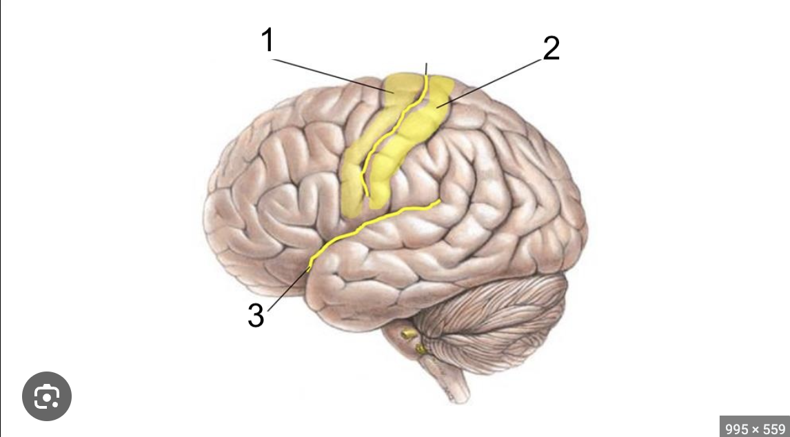 <p>What structure of the brain is this? #3</p>