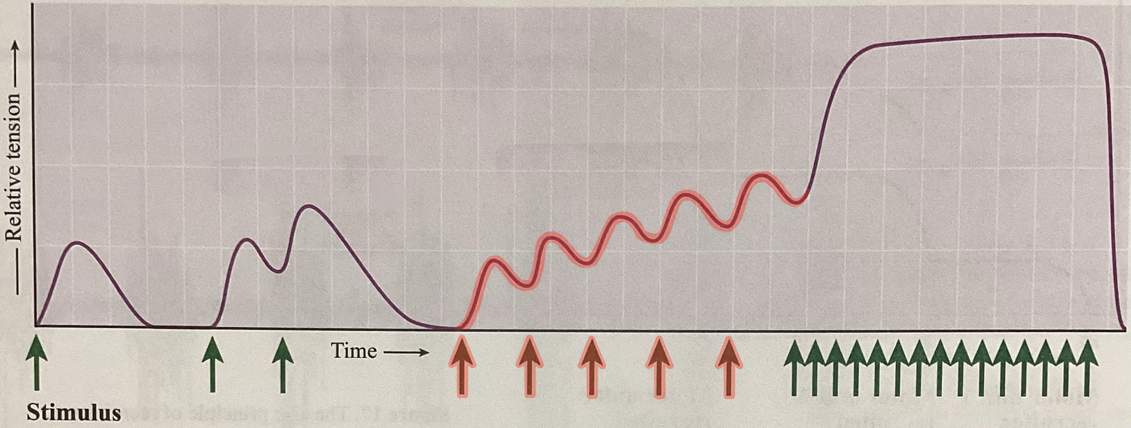 <p>What type of contraction is this?</p>