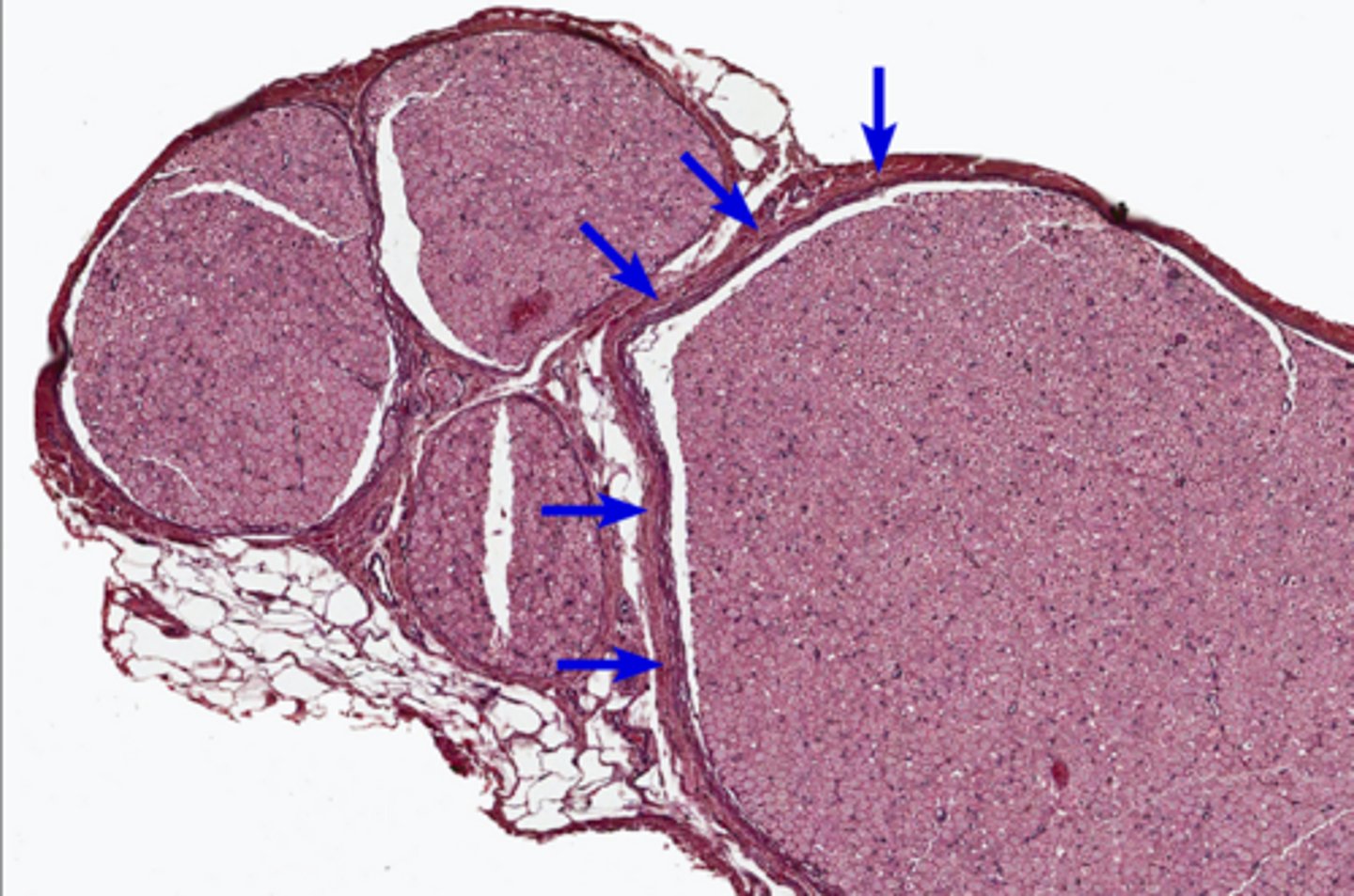 <p>outermost layer of connective tissue that surrounds an entire nerve</p>