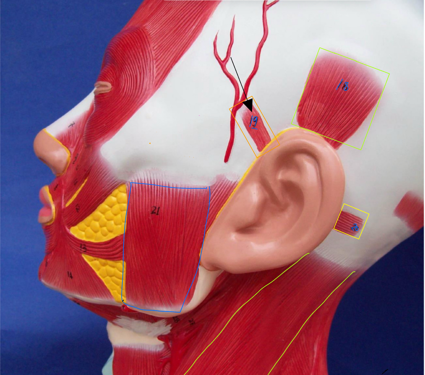 <p>What type of muscle is this ( altay model )</p>