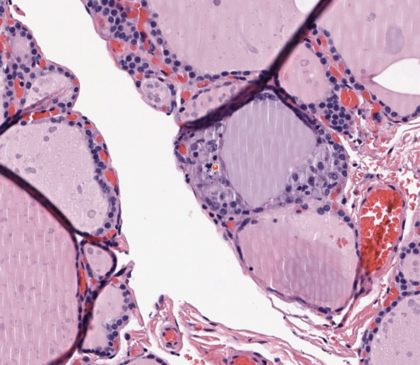 <p>Thyroid</p>