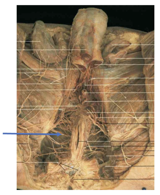 <p><span>Injury to this nerve would leave which of the following muscles affected?</span></p>