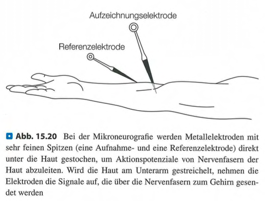 <p class=""><strong>Kurzfassung:</strong><br>Der Text zeigt, dass <strong>CT-Afferenzen</strong> spezialisierte Nervenfasern sind, die <strong>sanfte, soziale Berührungen</strong> auf behaarter Haut als <strong>angenehm</strong> vermitteln. Sie wirken unabhängig vom klassischen Tastsinn und aktivieren die <strong>Insula</strong>, ein emotionales Zentrum im Gehirn.</p><div data-type="horizontalRule"><hr></div><p class=""><strong>Langfassung:</strong></p><ul><li><p class=""><strong>CT-Afferenzen:</strong></p><ul><li><p class="">Langsam leitende, <strong>nicht-myelinisierte Nervenfasern</strong> in <strong>behaarter Haut</strong></p></li><li><p class=""><strong>Entdeckt durch Mikroneurografie</strong> – ihre Funktion war zunächst unklar</p></li></ul></li><li><p class=""><strong>Schlüsselerkenntnis (Olausson et al., 2002):</strong></p><ul><li><p class="">Patientin <strong>G.L.</strong> ohne myelinisierte Fasern → kein normaler Tastsinn</p></li><li><p class="">Sie konnte trotzdem <strong>leichtes Streicheln spüren</strong>, was zur Aktivierung der <strong>Insula</strong> führte</p></li><li><p class="">Zeigt, dass <strong>CT-Afferenzen</strong> soziale Berührungen unabhängig vom klassischen Tastsystem vermitteln</p></li></ul></li><li><p class=""><strong>Funktion:</strong></p><ul><li><p class="">Reagieren selektiv auf <strong>langsames, sanftes Streicheln</strong></p></li><li><p class="">Zuständig für <strong>emotionale, zwischenmenschliche Berührungen</strong> (z. B. Zärtlichkeit, Trost)</p></li><li><p class="">Vermitteln <strong>Angenehmheit</strong>, nicht Objektinformationen</p></li><li><p class="">Unterstützen soziale Bindung und <strong>emotionale Nähe</strong></p></li></ul></li><li><p class=""><strong>Fazit:</strong><br>CT-Afferenzen bilden ein eigenes taktiles System für <strong>sozial relevante, emotionale Berührung</strong> und sind wichtig für <strong>zwischenmenschliche Kommunikation</strong>.</p></li></ul><p></p>