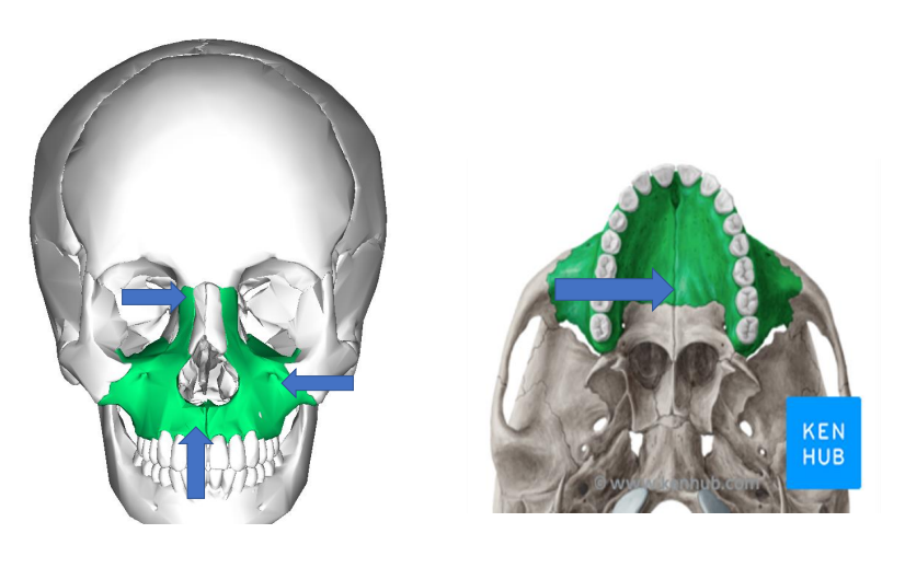 term image