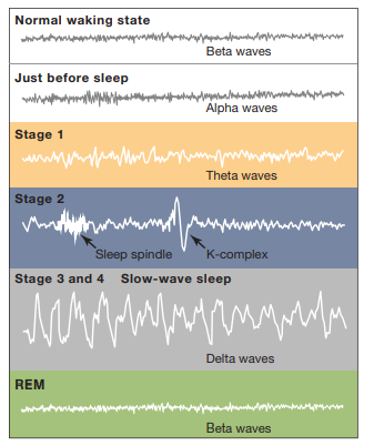 This chart shows how brain activity appears on an EEG for each stage