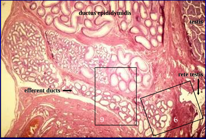 <p>Canine epididymis and rete testis. </p><p>This figure was taken just to the left of figure #2 and shows the epididymis and the rete testis (right) penetrating the tunica albuginea and seemingly trying to connect with the epididymis. </p>