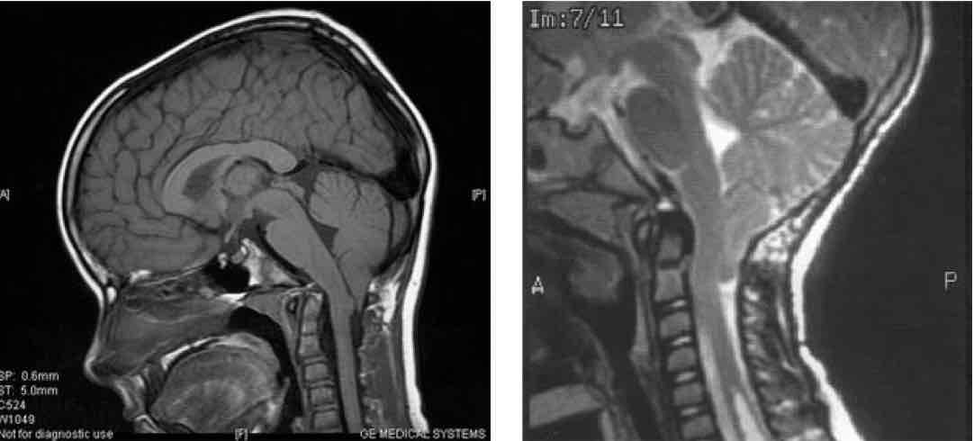 <p>What is happening in this image? What condition is causing this?</p>