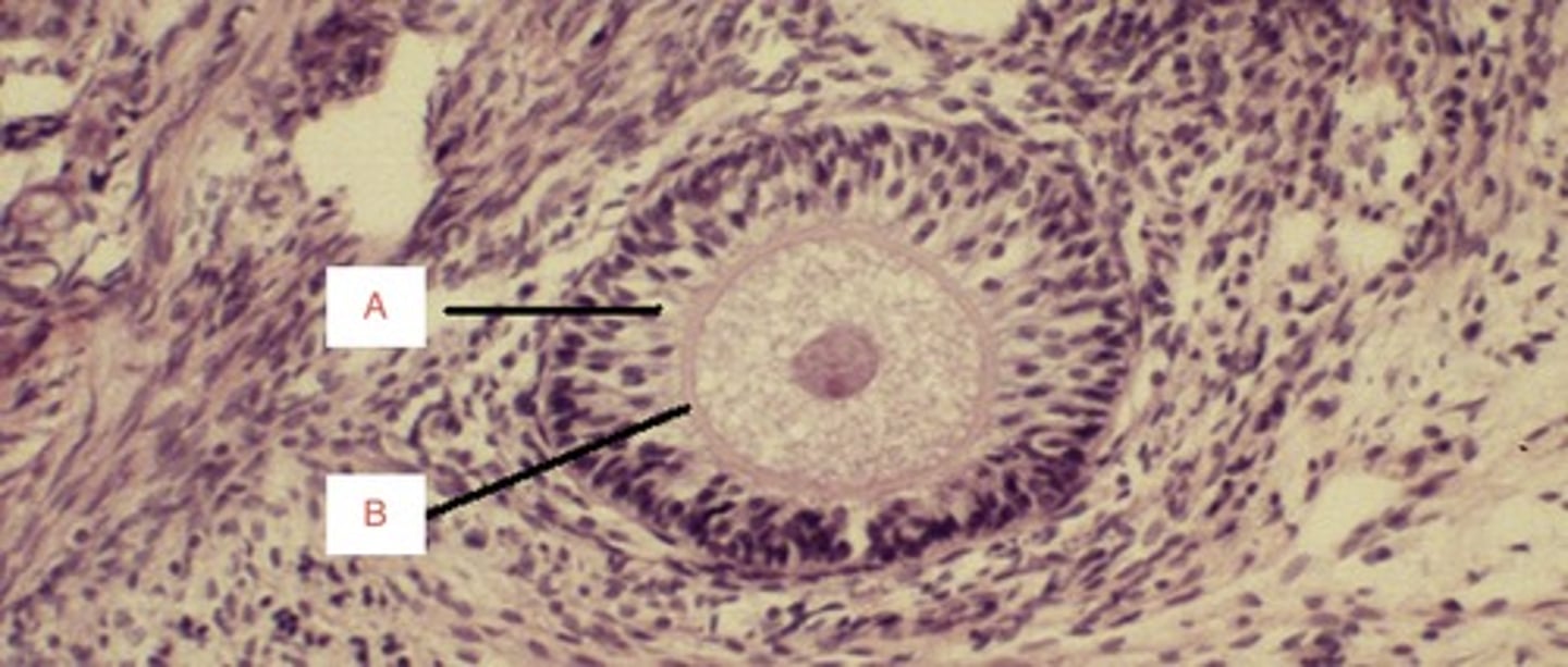 <p>A</p>