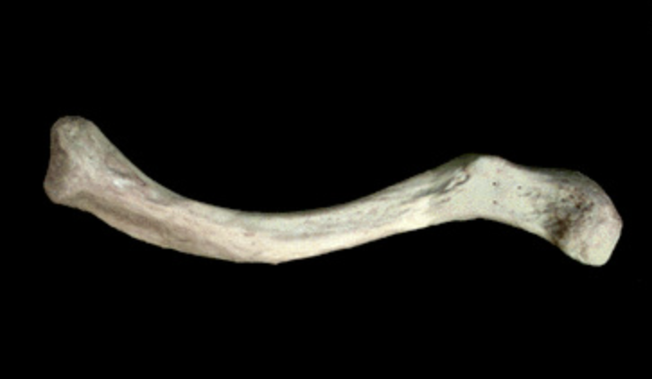<p>What is this bone?</p>