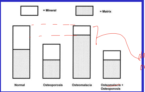 <p>pathology in matrix, bone mass and density, or mineralization of bone, examples include: </p><ul><li><p>osteoporosis/penia</p></li><li><p>osteopetrosis </p></li><li><p>ostomalacia </p></li></ul><p></p>