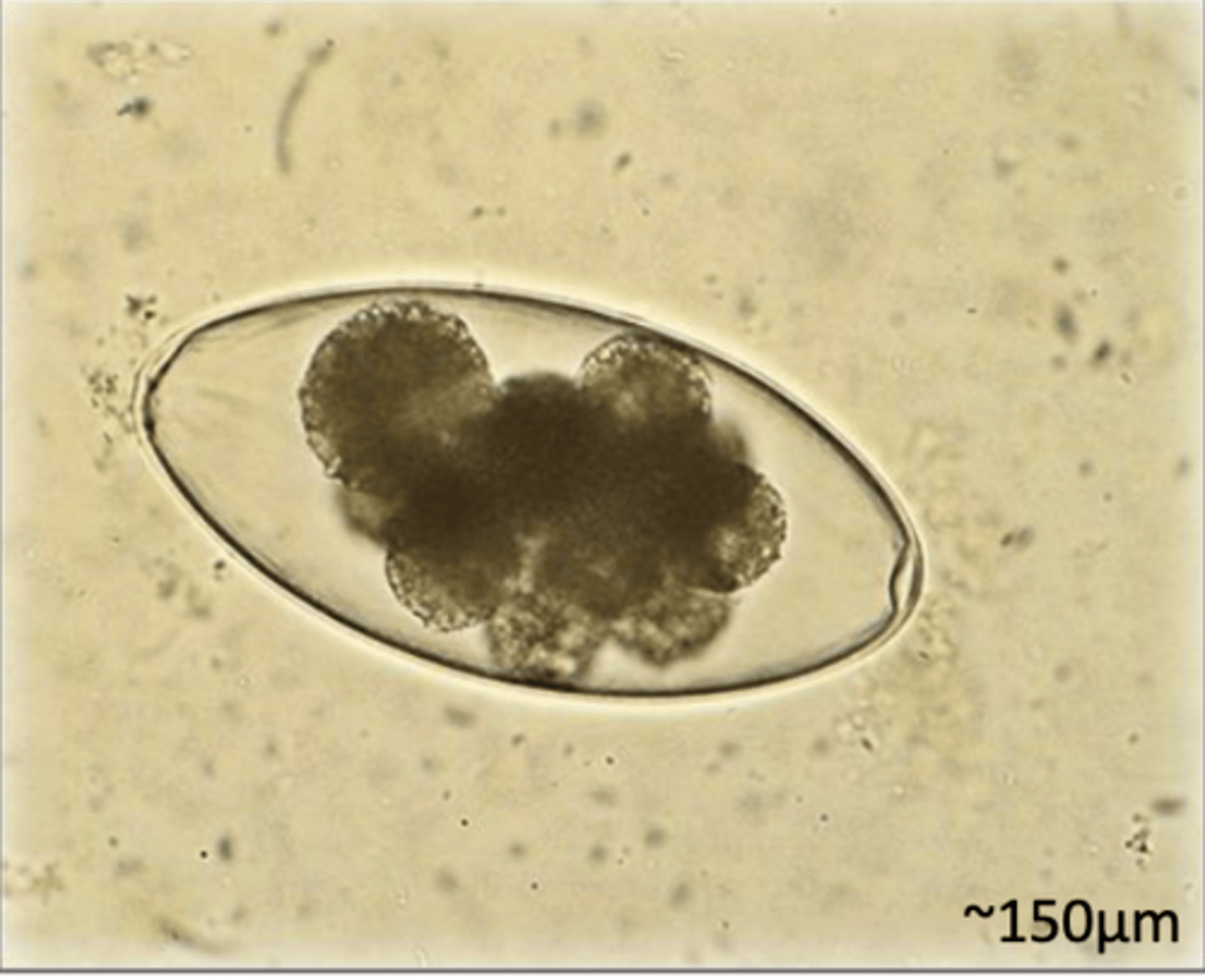 <p>What egg does this parasite belong to? What characteristic/s did you use to identify it?</p>