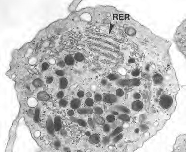 <p>What is the structure of the rough endoplasmic reticulum (RER)?</p>