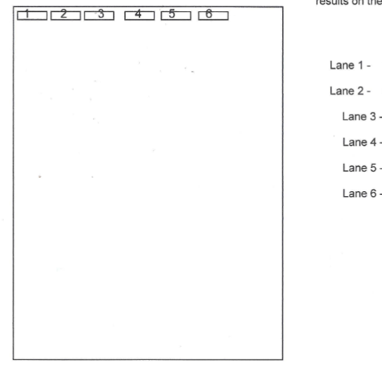 <p>What are each of the 6 gel lanes used to detect in molecular cloning gel electrophoresis?</p>