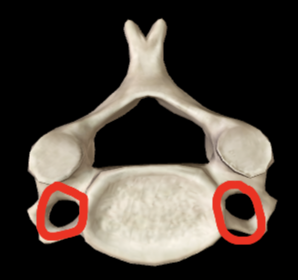 <p>Name this feature of the vertebrae</p>