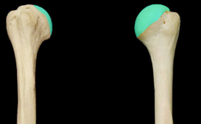 <p>what part of the humerus is this </p>