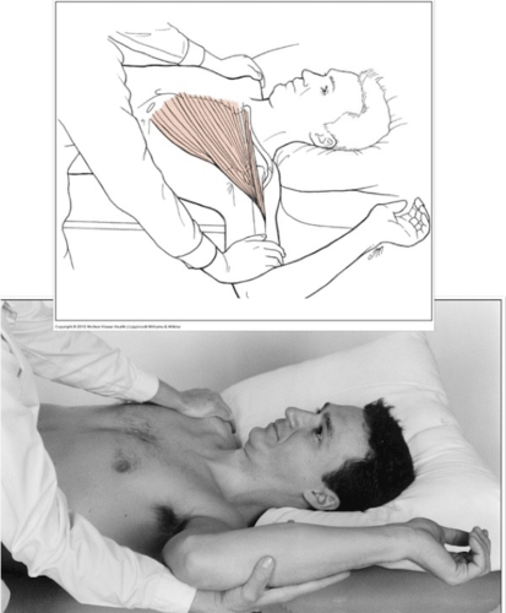 <p>Starting position: supine, shoulder ER, and abducted</p><p>- clavicular head: 90</p><p>- sternal head: 140</p><p>Testing motion: Allow the humerus to lower toward the ground until resistance is felt </p><p>Negative: humerus falls below horizontal</p><p>Positive: elbow does not reach the table, above horizontal </p>