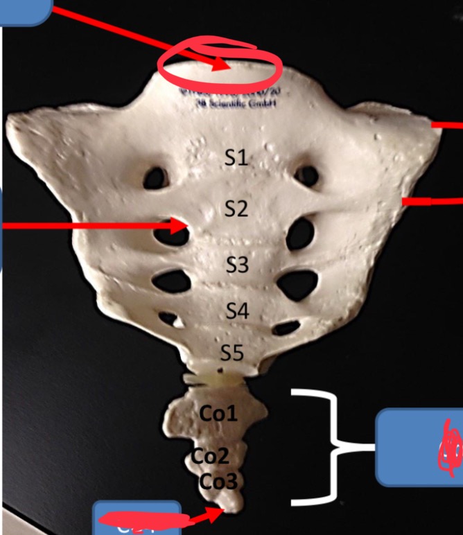 <p>Sacral promontory </p>