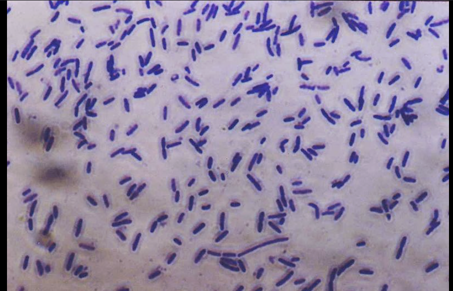 <p>How do you know if you are looking at a simple stain?</p>