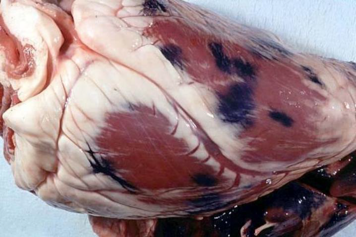 <p>pathological deposition of melanin</p>