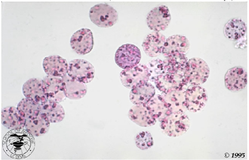 <p><span>Small scattered blue dot-like structures of varying size in the RBC – <em><u>stained with supravital stain</u></em></span></p><p><span>If 1-4 found, considered normal, 5 or more/cell is considered pathogenic</span></p>