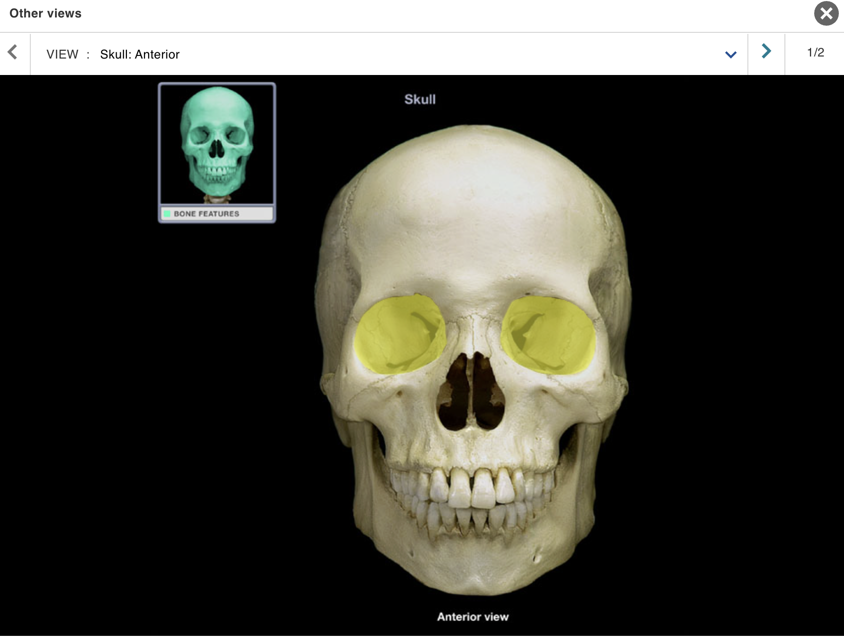 <p>Location:</p><ul><li><p>﻿﻿Skull (anterior)</p></li><li><p>﻿﻿Lateral to nasal cavity</p></li></ul><p>Description:</p><ul><li><p>﻿﻿Pyramidal space with roof, floor, and medial and lateral walls</p></li><li><p>﻿﻿Roof: frontal and sphenoid bones</p></li><li><p>﻿﻿Floor: palatine and zygomatic bones, and maxilla</p></li><li><p>﻿﻿Lateral wall: zygomatic, sphenoid, and frontal bones</p></li><li><p>﻿﻿Medial wall: ethmoid and lacrimal bones, and maxilla</p></li><li><p>﻿﻿Openings include superior and inferior orbital fissures, and optic canal</p></li></ul><p>Also known as:</p><p class="p1">• Eye socket</p><p class="p1">Comment:</p><p class="p1">• Contains eyeball and its muscles; cranial nerves II, III, IV, V1, and VI; vasculature; lacrimal apparatus; and fat</p>