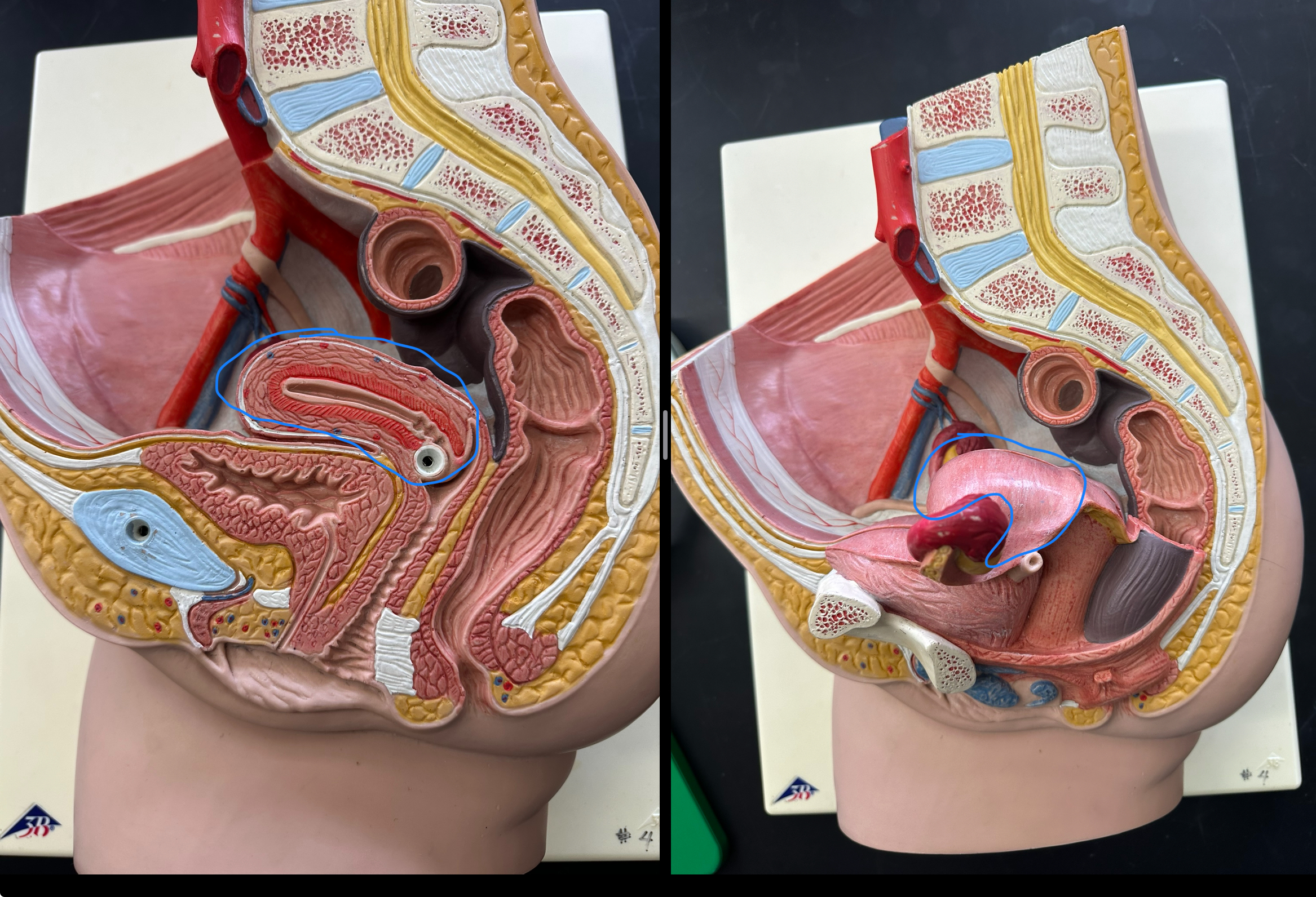<p>behind urinary bladder</p>