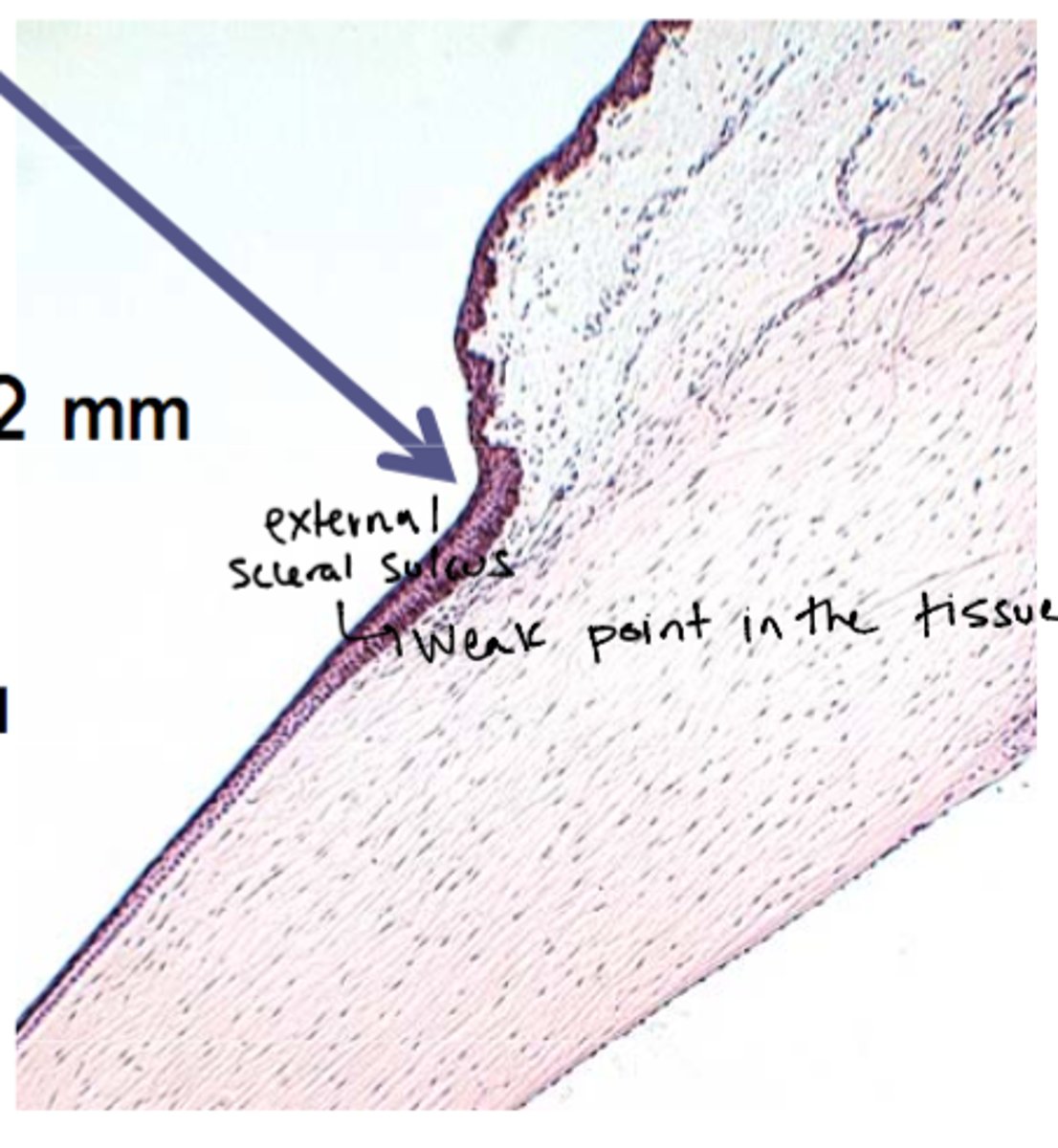 <p>junction between the cornea &amp; sclera</p>