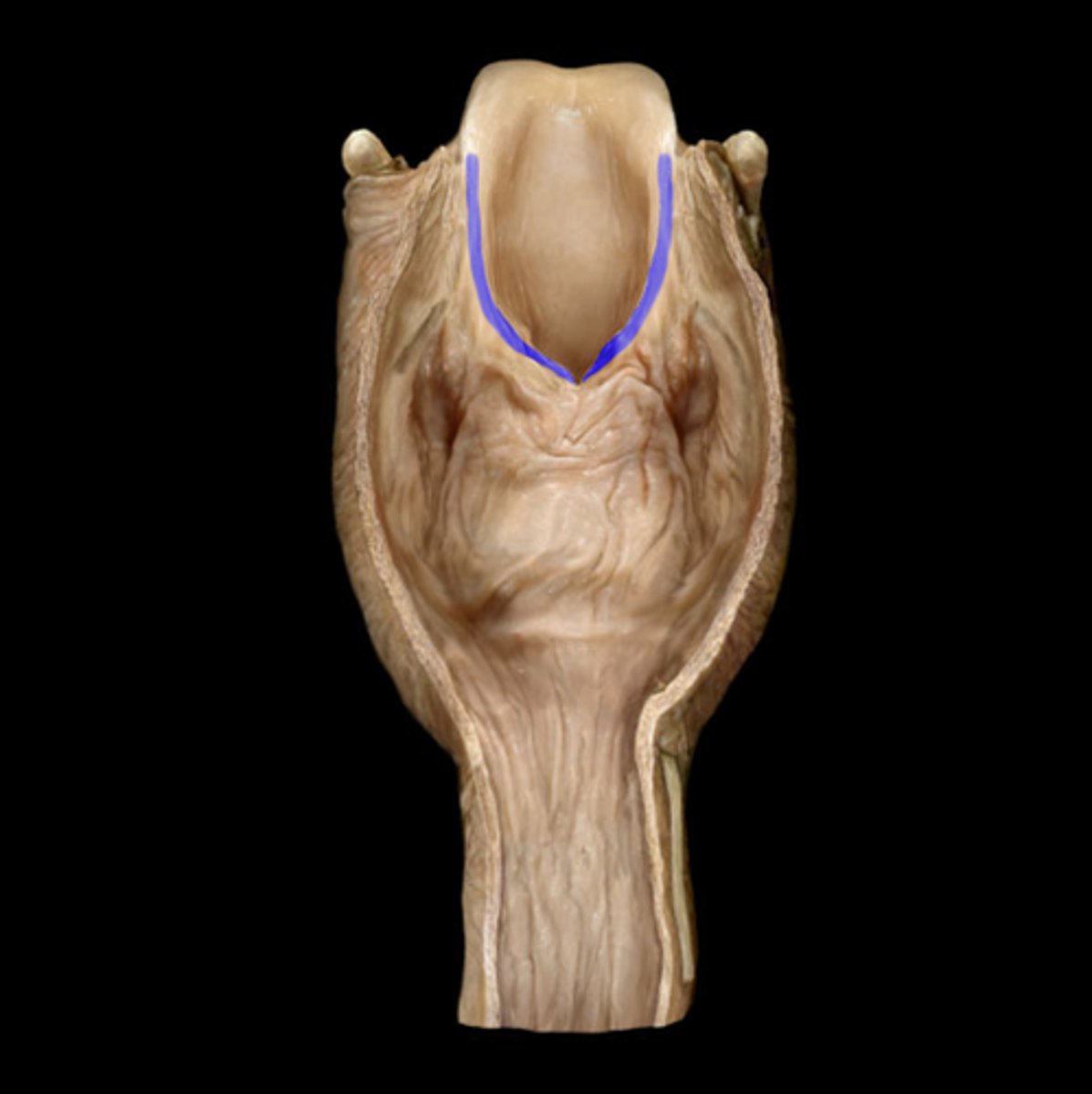 <p>ridges that make epiglottis slide tracts</p><ul><li><p>ridges</p></li></ul><p></p>