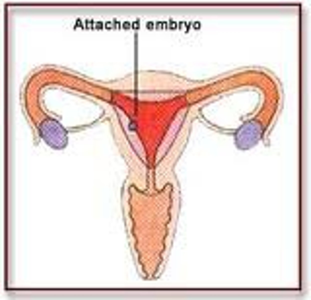 <p>The process by which the zygote attaches to the uterine wall</p>